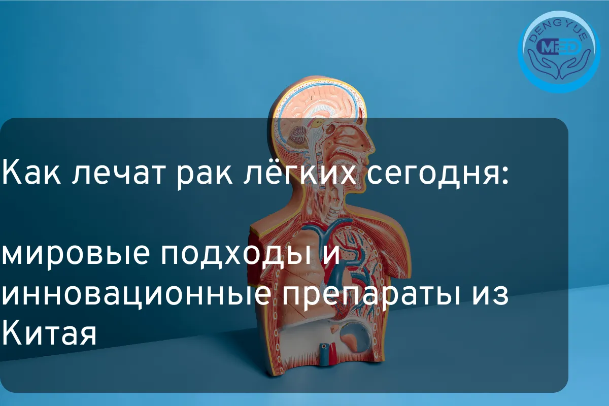 Как лечат рак лёгких сегодня мировые подходы и инновационные препараты из Китая
