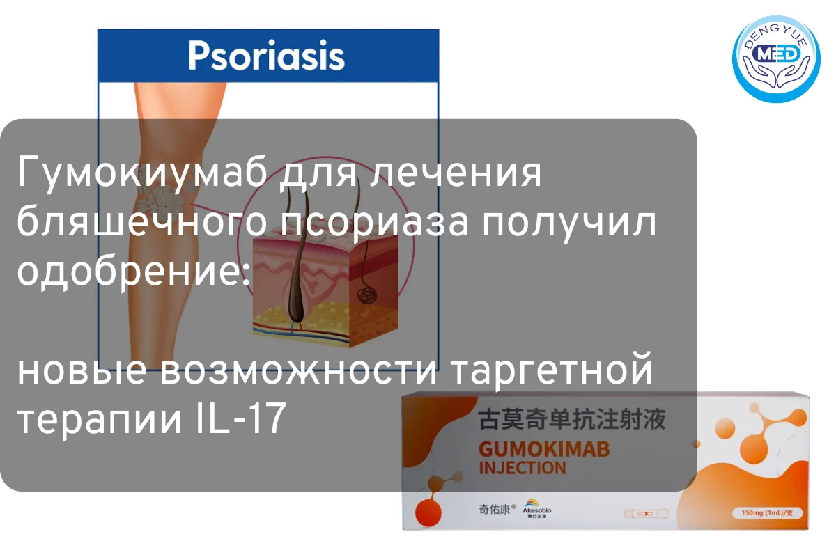 Гумокиумаб для лечения бляшечного псориаза получил одобрение: новые возможности таргетной терапии IL-17